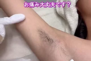 JCの脇毛脱毛動画がエ